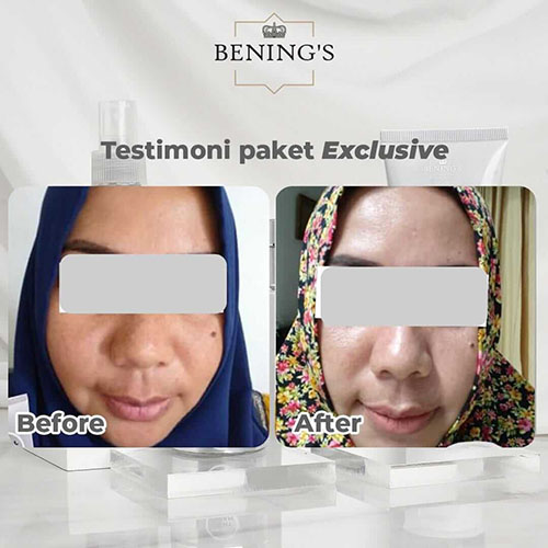 Testi11